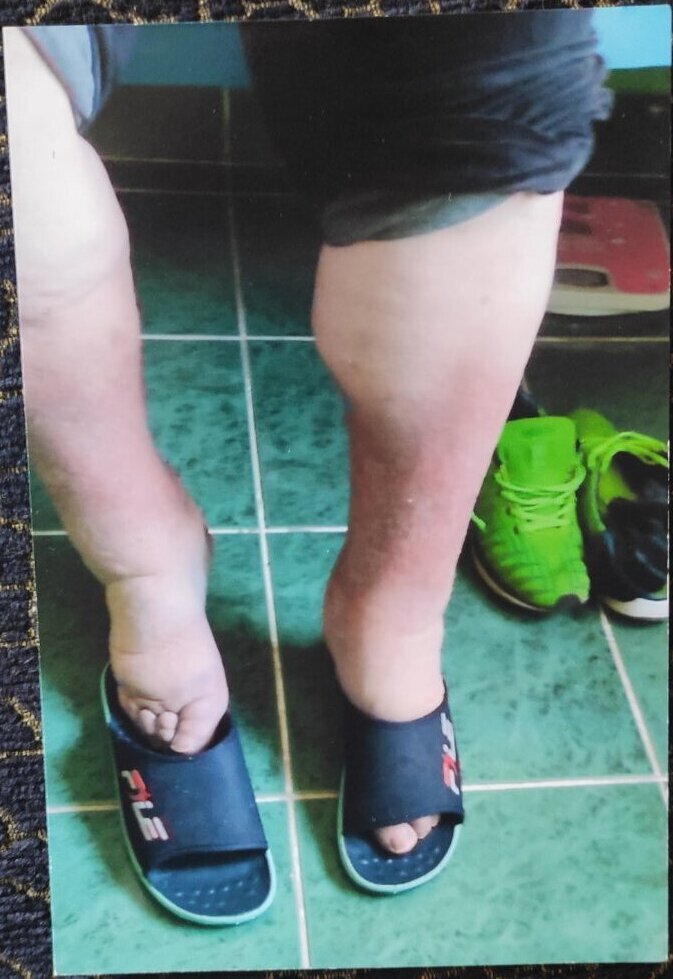 hiperbarična komora